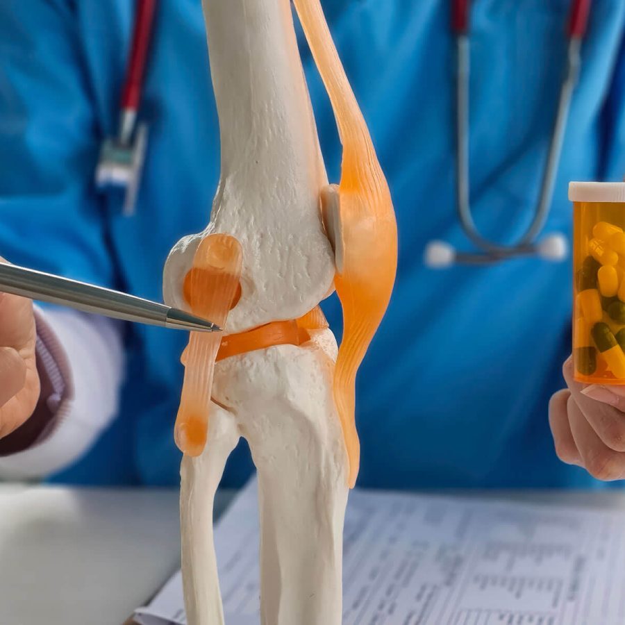 Prise en charge de l'arthrose : antalgiques et anti-inflammatoires