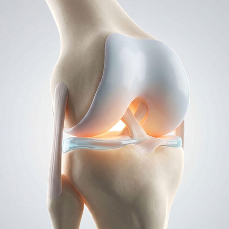 Qu’est-ce que l’arthrose ?